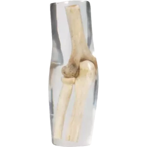 Fantôme radiographique du coude Erler Zimmer