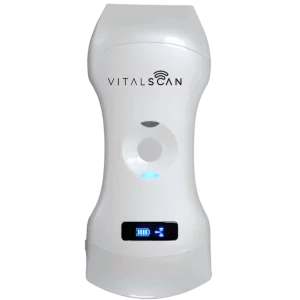 Echographe ultraportable connecté Vital Scan X5