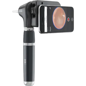 Otoscope LED Macroview 2 Plus iExaminer Welch Allyn