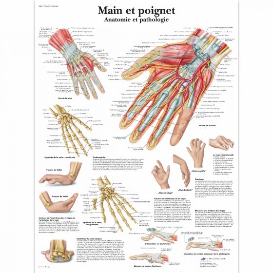 Planche anatomique Main et poignet - Anatomie et pathologie VR2171L