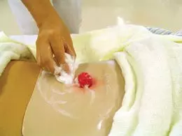 Modèle I pour l’entraînement à la stomathérapie avec boîte W60909