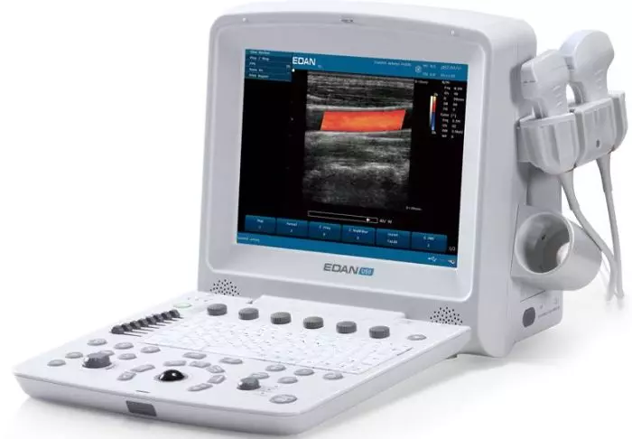 Echographe portable à ultrasons Edan U50 (couleur)