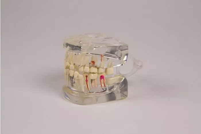 Mâchoire humaine transparente avec denture D19 Erler Zimmer