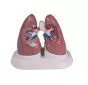 Set de poumons malades G52 Erler Zimmer