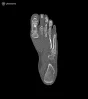 Fantôme de pied pour tomodensitométrie radiographie et radiothérapie Erler Zimmer