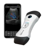 Echographe ultraportable connecté Bionet SonoMe