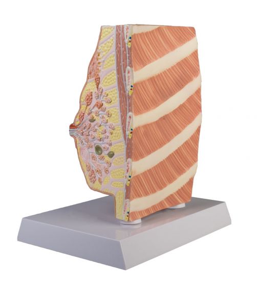 Modèle Anatomique Coupe Transversale Cancer Du Sein GPI LFA #3450